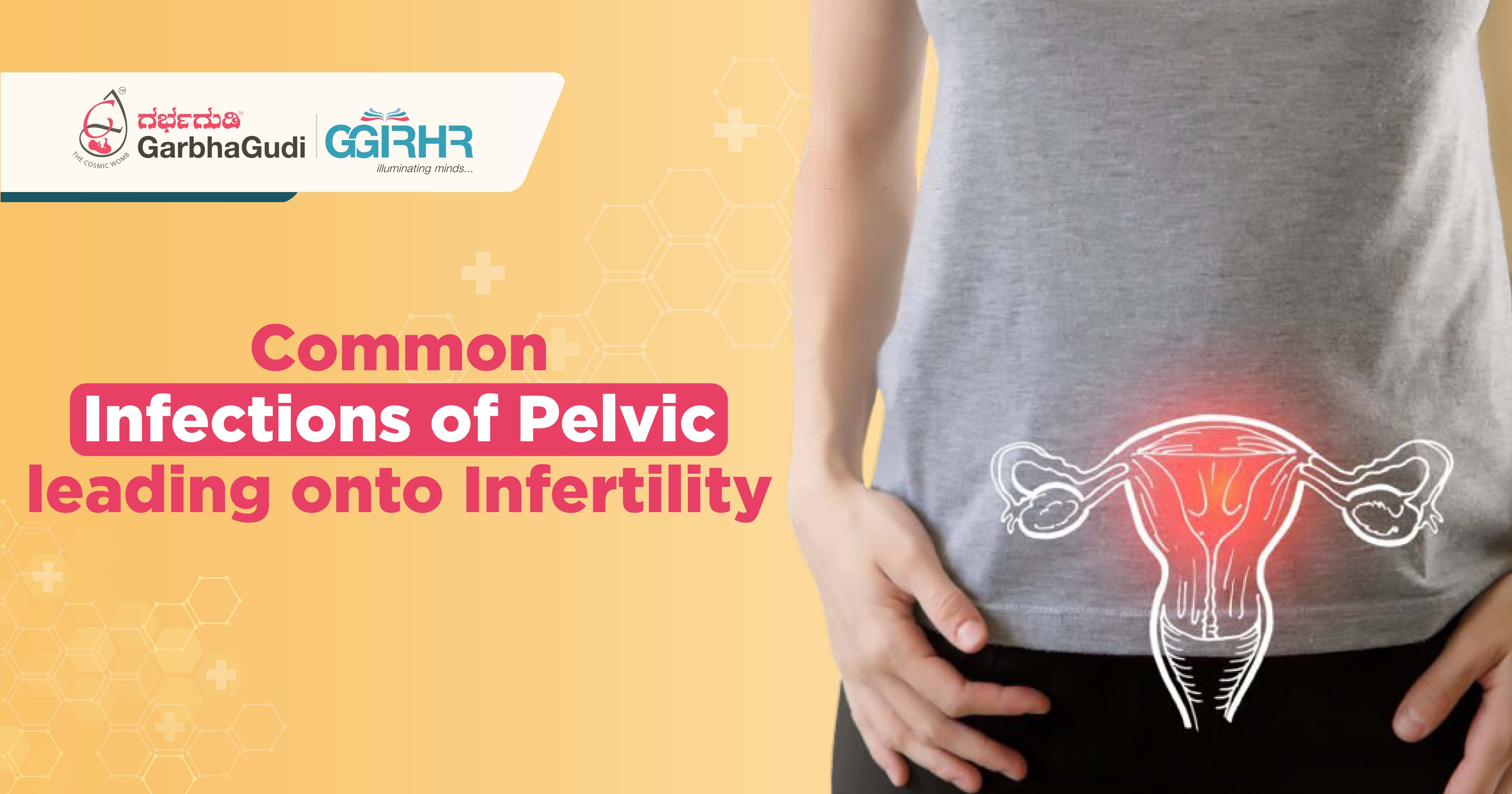 Common Infections of Pelvis Leading Onto Infertility