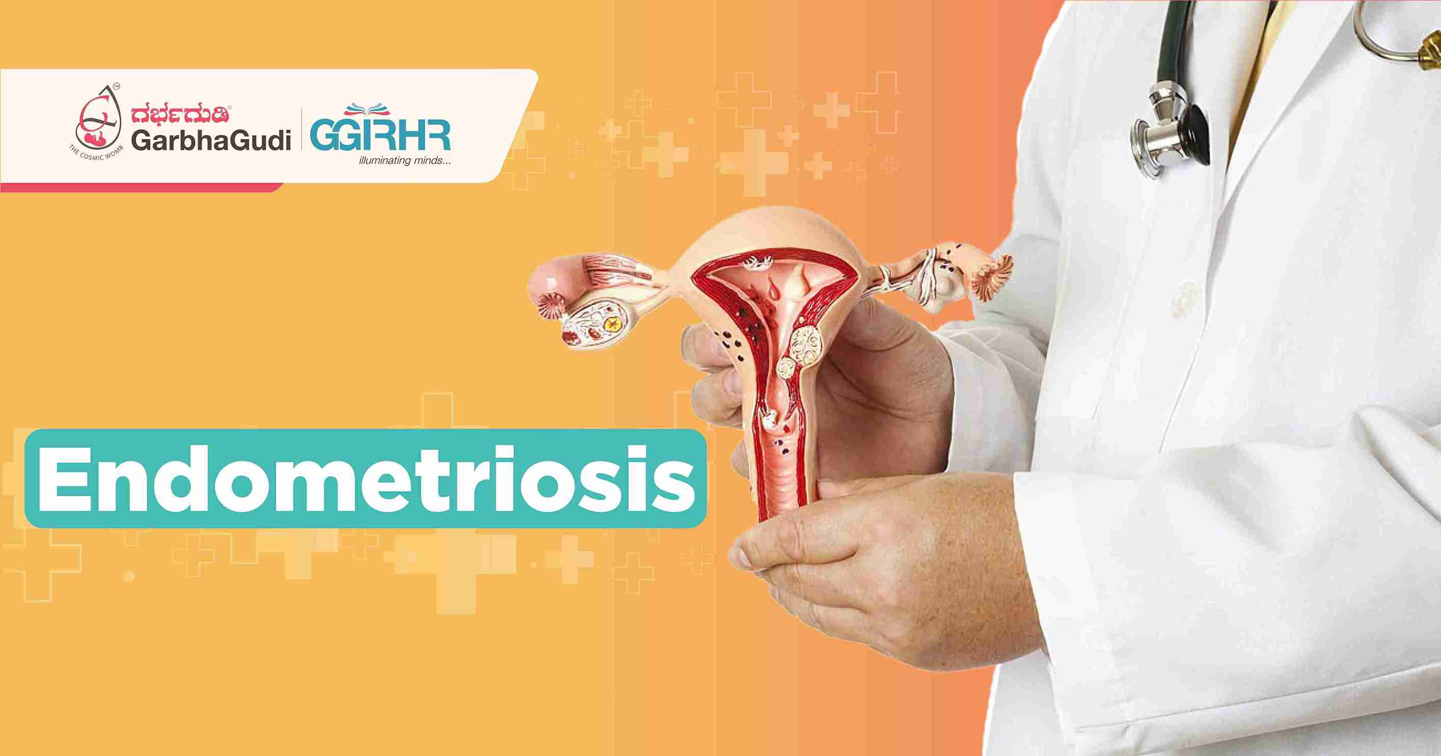 Endometriosis