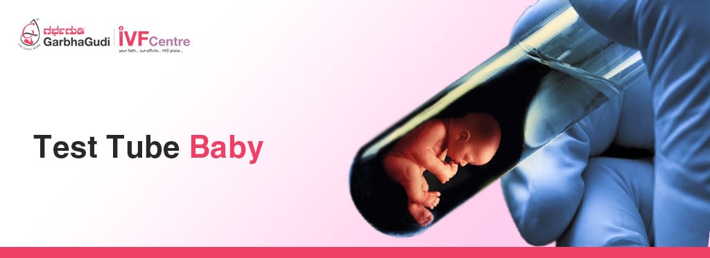 Test Tube Baby: Process, Benefits & Success Rate | Garbhagudi