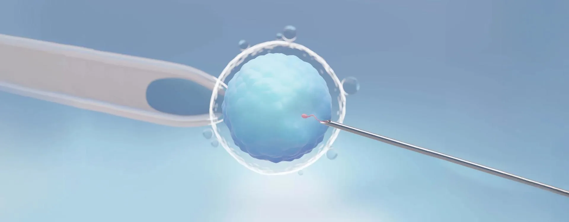 IVF Treatment