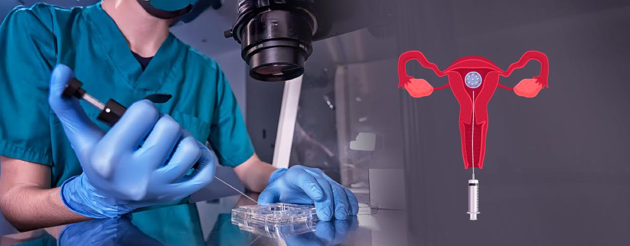 Sequential Embryo Transfer (SET) – A Revolutionary Step Towards Parenthood