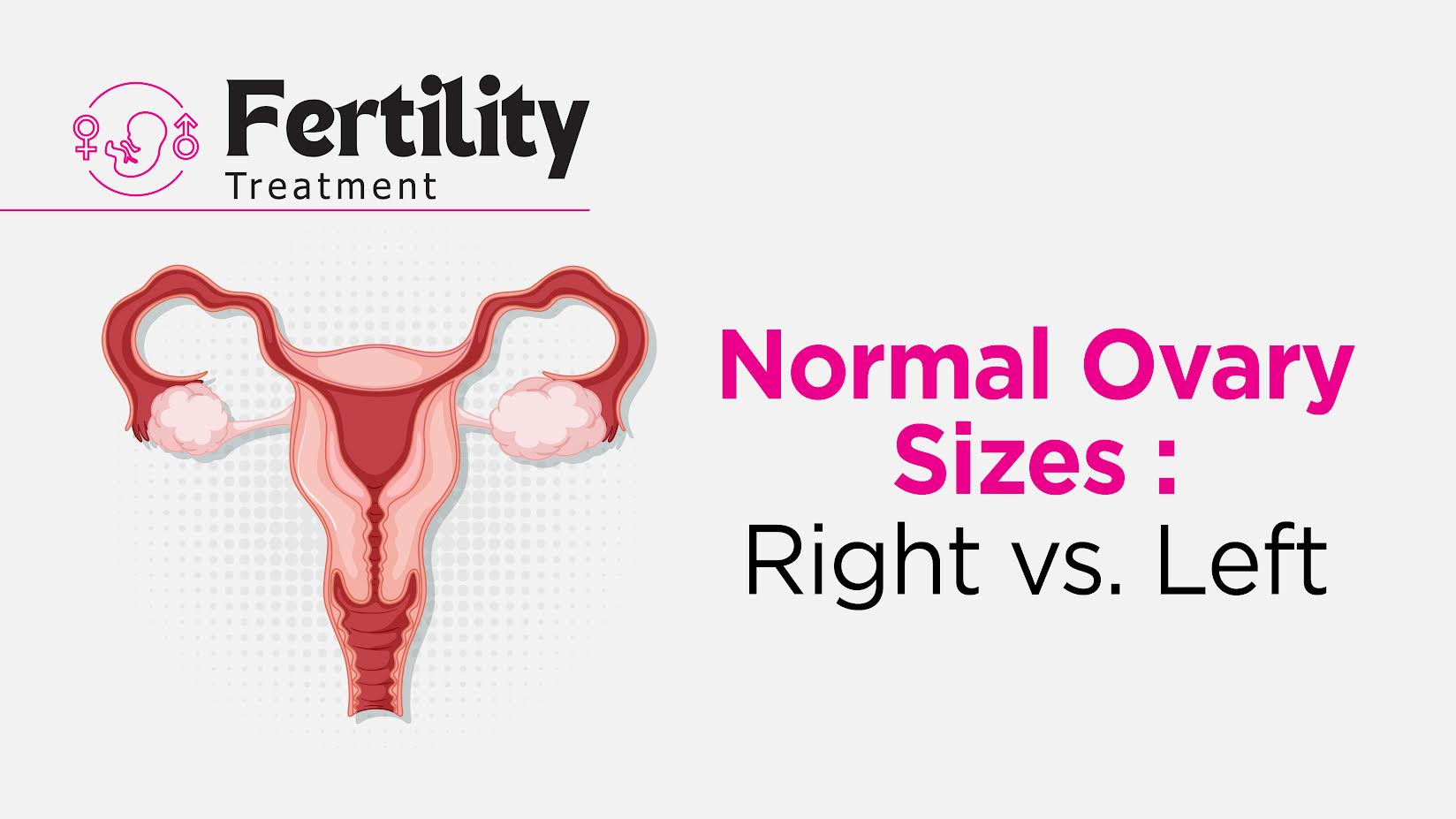 Normal Ovary Sizes - Right vs. Left